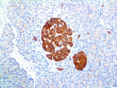 IHC of Synaptophysin on an FFPE Pancreas Tissue